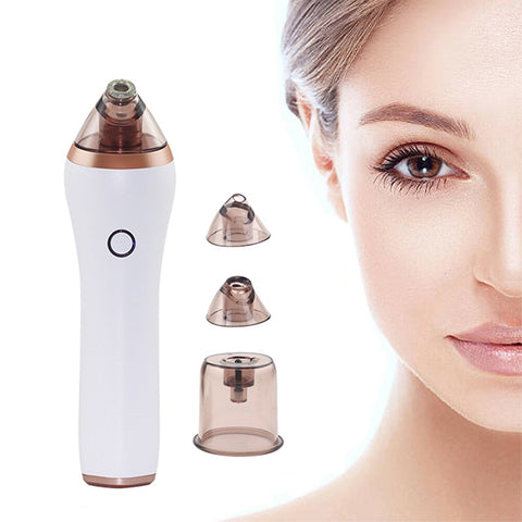 Portable Pore Cleaner – Remove Blackheads for Smooth, Healthy-Looking Skin
