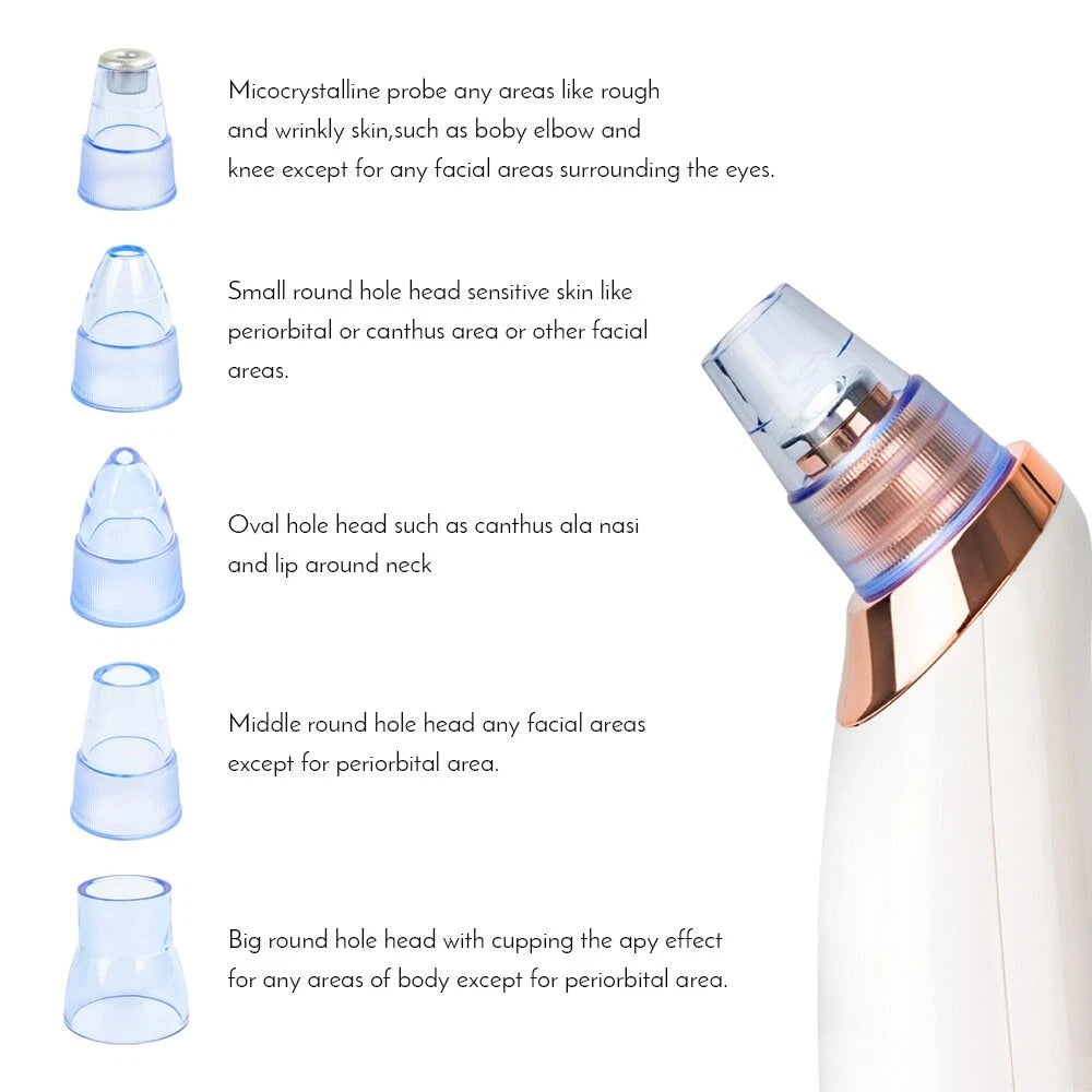 Portable Pore Cleaner – Remove Blackheads for Smooth, Healthy-Looking Skin